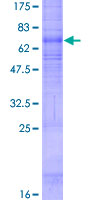ab160220 on a 12.5% SDS-PAGE stained with Coomassie Blue.