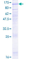 ab153472 on a 12.5% SDS-PAGE stained with Coomassie Blue.