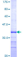 ab153473 on a 12.5% SDS-PAGE stained with Coomassie Blue.