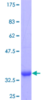 ab153471 on a 12.5% SDS-PAGE stained with Coomassie Blue.