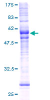 ab165129 on a 12.5% SDS-PAGE stained with Coomassie Blue.