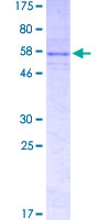 ab153435 on a 12.5% SDS-PAGE stained with Coomassie Blue.