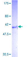ab153607 on a 12.5% SDS-PAGE stained with Coomassie Blue.
