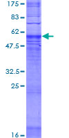 ab165111 on a 12.5% SDS-PAGE stained with Coomassie Blue.
