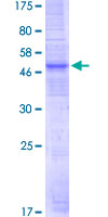 ab165503 on a 12.5% SDS-PAGE stained with Coomassie Blue.