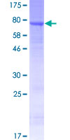 ab166342 on a 12.5% SDS-PAGE stained with Coomassie Blue.