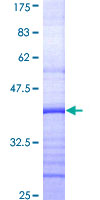 ab162565 on a 12.5% SDS-PAGE stained with Coomassie Blue.