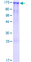 ab165056 on a 12.5% SDS-PAGE stained with Coomassie Blue.