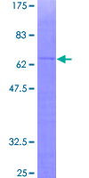 ab158575 on a 12.5% SDS-PAGE stained with Coomassie Blue.