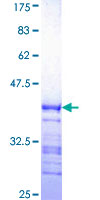 ab158576 on a 12.5% SDS-PAGE stained with Coomassie Blue.