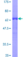 ab161891 on a 12.5% SDS-PAGE stained with Coomassie Blue.