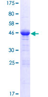 ab161892 on a 12.5% SDS-PAGE stained with Coomassie Blue.