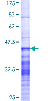 ab153308 on a 12.5% SDS-PAGE stained with Coomassie Blue.
