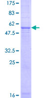 ab160529 on a 12.5% SDS-PAGE stained with Coomassie Blue.