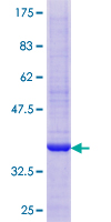 ab158577 on a 12.5% SDS-PAGE stained with Coomassie Blue.