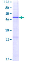 ab166559 on a 12.5% SDS-PAGE stained with Coomassie Blue.