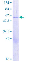 ab158621 on a 12.5% SDS-PAGE stained with Coomassie Blue.