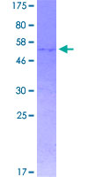 ab158622 on a 12.5% SDS-PAGE stained with Coomassie Blue.