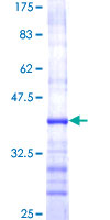 ab158623 on a 12.5% SDS-PAGE stained with Coomassie Blue.