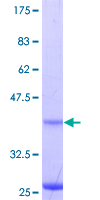 ab163407 on a 12.5% SDS-PAGE stained with Coomassie Blue.