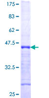 ab153489 on a 12.5% SDS-PAGE stained with Coomassie Blue.