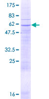 ab159935 on a 12.5% SDS-PAGE stained with Coomassie Blue.