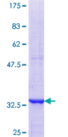 ab159936 on a 12.5% SDS-PAGE stained with Coomassie Blue.