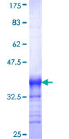 ab159106 on a 12.5% SDS-PAGE stained with Coomassie Blue.