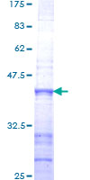 ab158579 on a 12.5% SDS-PAGE stained with Coomassie Blue.