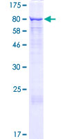 ab153516 on a 12.5% SDS-PAGE stained with Coomassie Blue.
