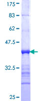 ab153517 on a 12.5% SDS-PAGE stained with Coomassie Blue.