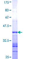 ab158580 on a 12.5% SDS-PAGE stained with Coomassie Blue.