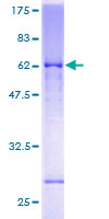 ab158581 on a 12.5% SDS-PAGE stained with Coomassie Blue.