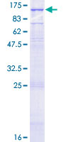 ab158582 on a 12.5% SDS-PAGE stained with Coomassie Blue.