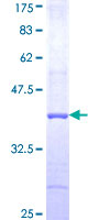 ab158583 on a 12.5% SDS-PAGE stained with Coomassie Blue.