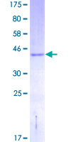 ab162405 on a 12.5% SDS-PAGE stained with Coomassie Blue.