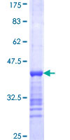 ab161639 on a 12.5% SDS-PAGE stained with Coomassie Blue.