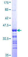 ab159349 on a 12.5% SDS-PAGE stained with Coomassie Blue.