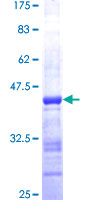 ab158570 on a 12.5% SDS-PAGE stained with Coomassie Blue.