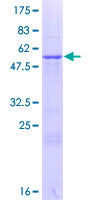 ab165378 on a 12.5% SDS-PAGE stained with Coomassie Blue.