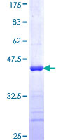 ab158594 on a 12.5% SDS-PAGE stained with Coomassie Blue.