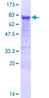 ab164438 on a 12.5% SDS-PAGE stained with Coomassie Blue.