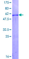 ab153603 on a 12.5% SDS-PAGE stained with Coomassie Blue.