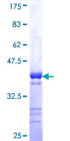 ab153604 on a 12.5% SDS-PAGE stained with Coomassie Blue.
