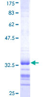 ab165820 on a 12.5% SDS-PAGE stained with Coomassie Blue.