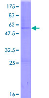 ab158596 on a 12.5% SDS-PAGE stained with Coomassie Blue.