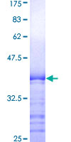 ab158597 on a 12.5% SDS-PAGE stained with Coomassie Blue.