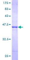ab158602 on a 12.5% SDS-PAGE stained with Coomassie Blue.