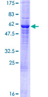 ab158603 on a 12.5% SDS-PAGE stained with Coomassie Blue.