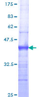 ab158604 on a 12.5% SDS-PAGE stained with Coomassie Blue.